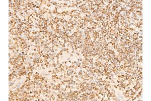 Immunohistochemistry (IHC) image for anti-Eukaryotic Translation Initiation Factor 2 Subunit 1 (EIF2S1) (pSer51) antibody (ABIN6255389)