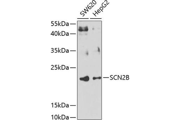 SCN2B 抗体  (AA 30-160)