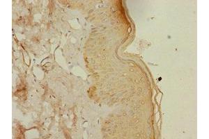 Immunohistochemistry of paraffin-embedded human skin tissue using ABIN7164417 at dilution of 1:100 (DTX2 antibody  (AA 1-280))