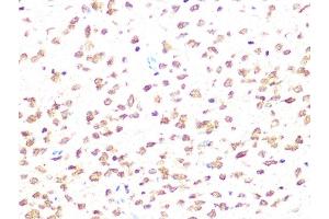 Immunohistochemistry (IHC) image for anti-Casein Kinase 2, beta (CSNK2B) antibody (ABIN1680593)