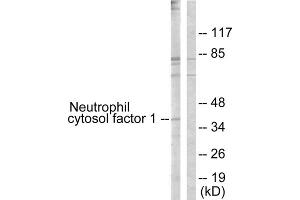 Western blot analysis of extracts from COS7 cells, treated with UV (15mins), using Neutrophil Cytosol Factor 1 (epitope around residue 304) antibody. (NCF1 antibody  (Ser304))