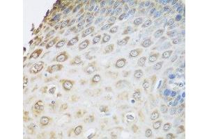 Immunohistochemistry of paraffin-embedded Human esophagus using GRPEL2 Polyclonal Antibody at dilution of 1:100 (40x lens). (GRPEL2 antibody)