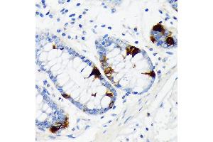 Immunohistochemistry of paraffin-embedded human colon using Chromogranin A Rabbit mAb (ABIN7266366) at dilution of 1:100 (40x lens). (Chromogranin A antibody)