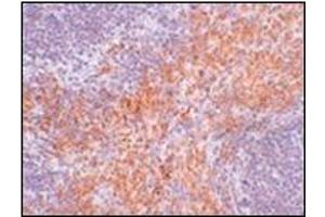 Immunohistochemistry of RIPK1 in mouse kidney tissue with this product at 2. (RIPK1 antibody  (N-Term))