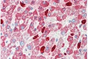 Human, Liver: Formalin-Fixed Paraffin-Embedded (FFPE) (CYP3A4 antibody  (AA 254-303))