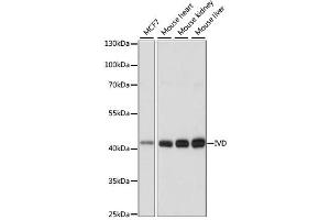 Western blot analysis of extracts of various cell lines, using IVD antibody. (IVD antibody)