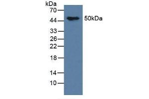 Figure. (tau antibody  (AA 92-400))