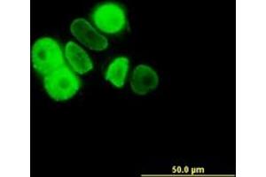 Image no. 2 for anti-Progesterone Receptor (PGR) (AA 1-111) antibody (ABIN598872) (Progesterone Receptor antibody  (AA 1-111))