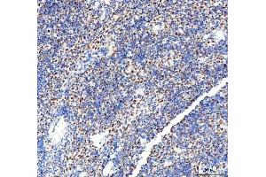 IHC analysis of DDX1 using anti-DDX1 antibody (ABIN7602052). (DDX1 antibody  (AA 562-740))