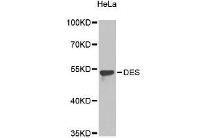 Western blot analysis of extracts of HeLa cells, using DES antibody (ABIN5996882). (Desmin antibody)