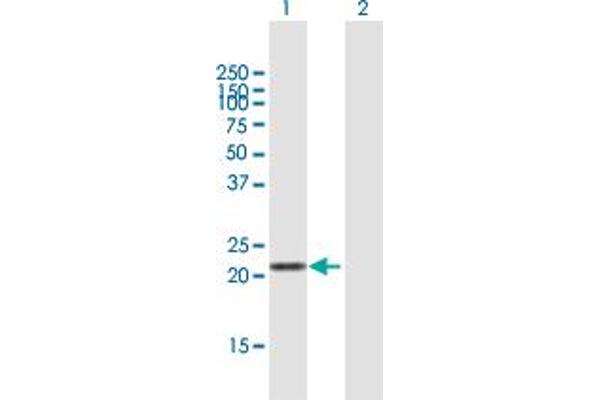 AQPEP antibody  (AA 1-198)