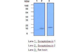 The recombinant Synaptobrevin 1,2(each 20ng) and the extracts of Rat brain(20 ug) were resolved by SDS-PAGE, transferred to PVDF membrane and probed with anti-human Synaptobrevin 2 (1:2,000). (VAMP2 antibody  (AA 1-89))