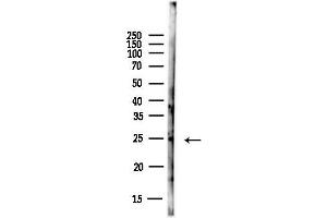 Western blot analysis of lysates from EC304 cells(heat-shock,45 min treatment), using ML1 Antibody at 1/1000 dilution.