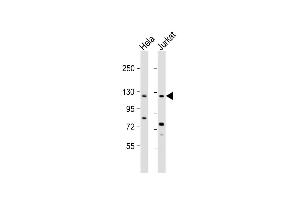 All lanes : Anti-SRG Antibody (C-term) at 1:2000 dilution Lane 1: Hela whole cell lysate Lane 2: Jurkat whole cell lysate Lysates/proteins at 20 μg per lane.