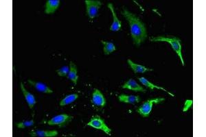 Immunofluorescent analysis of Hela cells using ABIN7151839 at dilution of 1:100 and Alexa Fluor 488-congugated AffiniPure Goat Anti-Rabbit IgG(H+L) (EPH Receptor A4 antibody  (AA 345-545))