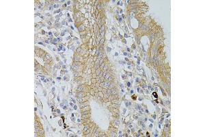Immunohistochemistry of paraffin-embedded human stomach using OCLN antibody. (Occludin antibody)