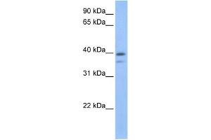 VPS26B antibody used at 1 ug/ml to detect target protein. (VPS26B antibody)