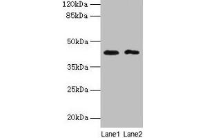 Western blot All lanes: BTBD2 antibody at 6 μg/mL Lane 1: Hela whole cell lysate Lane 2: MDA-MB-231 whole cell lysate Secondary Goat polyclonal to rabbit IgG at 1/10000 dilution Predicted band size: 56, 23 kDa Observed band size: 42 kDa
