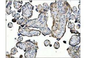 IHC analysis of ANGPT2 using anti-ANGPT2 antibody (ABIN7601450). (Angiopoietin 2 antibody  (AA 357-404))
