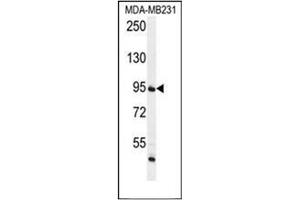 Western blot analysis of FTSJ3 Antibody (Center) in MDA-MB231 cell line lysates (35ug/lane). (FTSJ3 antibody  (Middle Region))