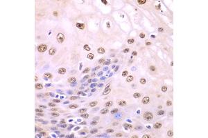 Immunohistochemistry of paraffin-embedded human esophagus using SQSTM1 antibody. (SQSTM1 antibody)