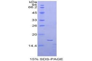 SDS-PAGE of Protein Standard from the Kit (Highly purified E. (alpha Fetoprotein ELISA Kit)