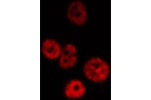 Immunofluorescence (fixed cells) (IF/ICC) image for anti-Nuclear Factor-kB p65 (NFkBP65) antibody (ABIN6263616)