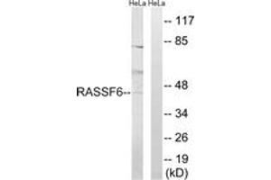 Western Blotting (WB) image for anti-Ras Association Domain-Containing Protein 6 (RASSF6) (AA 129-178) antibody (ABIN2890570) (RASSF6 antibody  (AA 129-178))