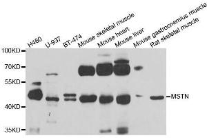 Western blot analysis of extracts of various cell lines, using MSTN antibody. (MSTN antibody  (AA 267-375))