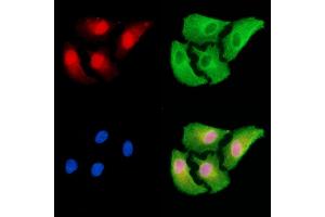 ABIN7094985 and ABIN7099041 staining  cells by IF/ICC. (MLXIPL antibody)
