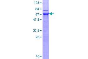 TTC1 Protein (AA 1-292) (GST tag)