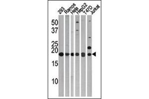 LC3C Antibody (APG8c) Cat. (LC3C antibody  (N-Term))