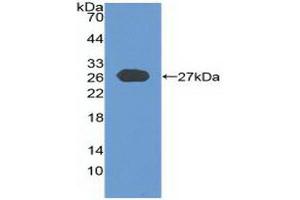 Western blot analysis of recombinant Human CYLD. (CYLD antibody  (AA 170-338))