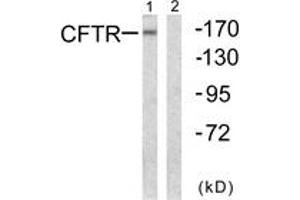 Western blot analysis of extracts from NIH-3T3 cells, using CFTR (Ab-737) Antibody.