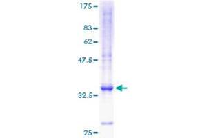 Image no. 1 for Chemokine (C-X-C Motif) Ligand 5 (CXCL5) (AA 1-114) protein (GST tag) (ABIN1350826) (CXCL5 Protein (AA 1-114) (GST tag))