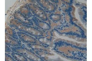 DAB staining on IHC-P; Samples: Rat Intestine Tissue (PLAT antibody  (AA 311-487))