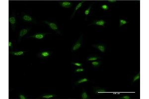 Immunofluorescence of monoclonal antibody to OLIG2 on HeLa cell. (OLIG2 antibody  (AA 2-78))
