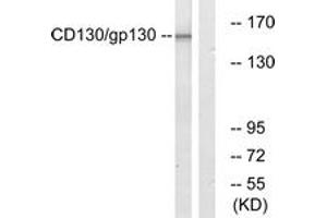 Western blot analysis of extracts from Jurkat cells, using CD130/gp130 (Ab-782) Antibody.