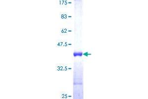 S100A3 Protein (AA 1-101) (GST tag)