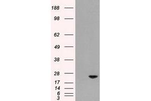 Image no. 1 for anti-Adenylate Kinase 1 (AK1) antibody (ABIN1496514) (Adenylate Kinase 1 antibody)