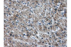 Immunohistochemical staining of paraffin-embedded liver tissue using anti-ATP5B mouse monoclonal antibody.