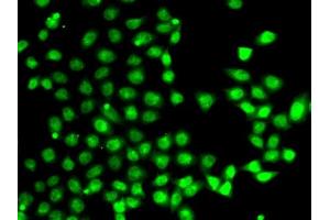 Immunofluorescence analysis of A-549 cells using E antibody (ABIN6127826, ABIN6139905, ABIN6139906 and ABIN6222933). (EAF2 antibody  (AA 1-170))