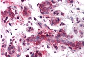 Human Breast: Formalin-Fixed, Paraffin-Embedded (FFPE) (RSPO1 antibody  (N-Term))