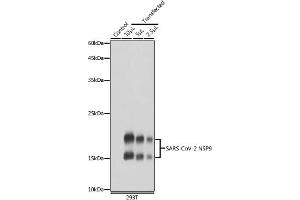 Western blot analysis of extracts of normal 293T cells and 293T transfected with NSP9 Protein, using SARS-CoV-2 NSP9 antibody (ABIN7268509) at 1:5000 dilution. (MHV NSP9 antibody)