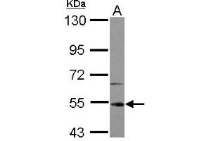 Image no. 2 for anti-Interleukin-1 Receptor-Associated Kinase 4 (IRAK4) (AA 27-288) antibody (ABIN1498897) (IRAK4 antibody  (AA 27-288))