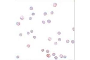 Immunocytochemistry of ZEB1 in HeLa cells with ZEB1 antibody at 20 μg/ml. (ZEB1 antibody  (Center))
