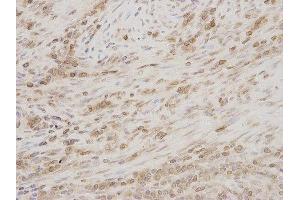 Immunohistochemistry (IHC) image for anti-Thymopoietin (TMPO) antibody (ABIN1875122) (Thymopoietin antibody)