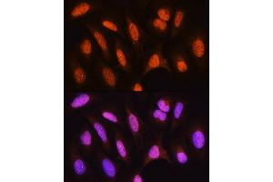 Immunofluorescence analysis of U2OS cells using HSP antibody (ABIN6128040, ABIN6142040, ABIN6142041 and ABIN6223893) at dilution of 1:100. (HSPA2 antibody  (AA 400-639))
