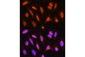 Immunofluorescence analysis of U2OS cells using HSP antibody (ABIN6128040, ABIN6142040, ABIN6142041 and ABIN6223893) at dilution of 1:100.