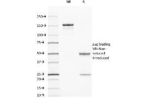 SDS-PAGE Analysis Purified Cytokeratin 7/17 Mouse Monoclonal Antibody (C-46). (Keratin 7/17 antibody)